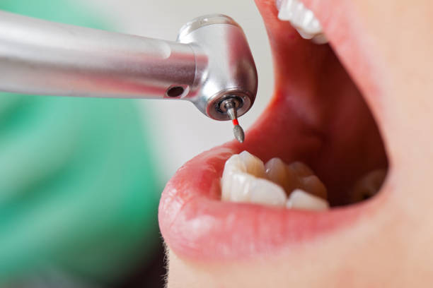 Best Emergency Dental Care for Broken or Chipped Teeth in Fairbanks, AK